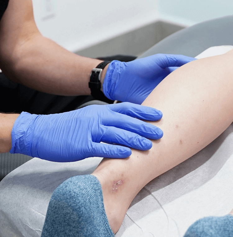 veinclinics_li_homereasons_img8@2x vipcenters_numeralsmobile_img3-min-1