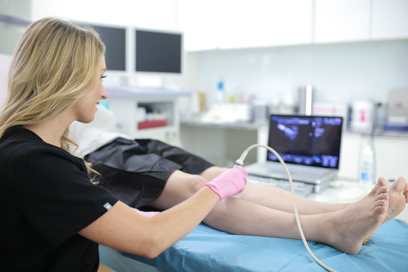 Why do my legs look worse after sclerotherapy? Does sclerotherapy look worse before better? Does sclerotherapy improve circulation? We answer your questions about spider vein treatments in California.